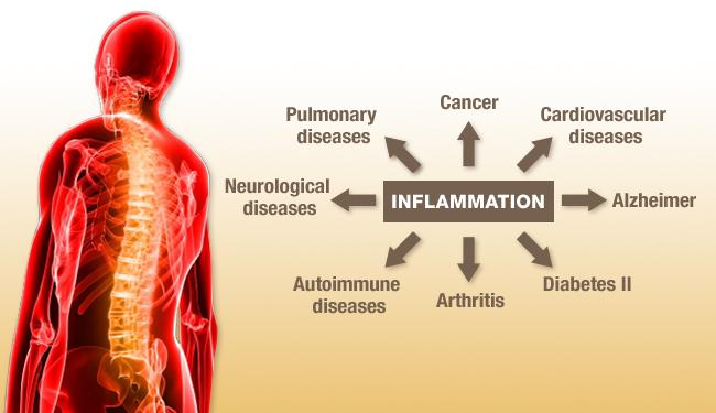 inflammation.jpg